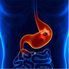 Endoscopía